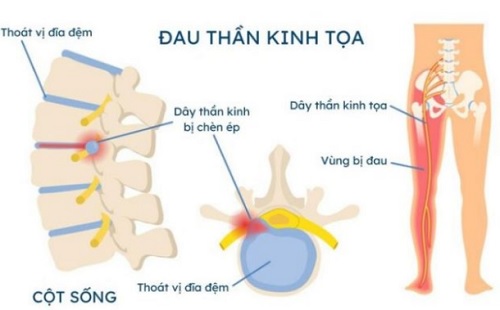 bài 9_3.jpg