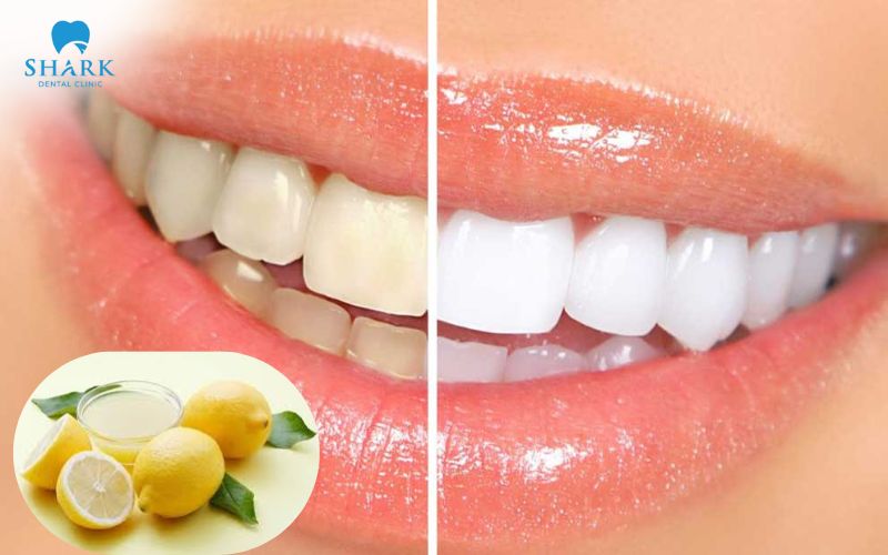 Sử dụng chanh làm trắng răng đơn giản tại nhà