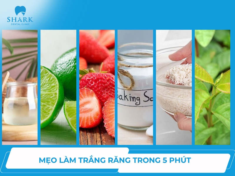 làm trắng răng trong 5 phút có thật sự hiệu quả