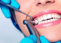 Dental Cleaning and Polishing _ Teeth Scaling And Polishing in Houston.jpg