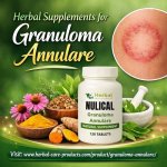 Effective herbal supplements for Granuloma Annulare symptoms.jpg